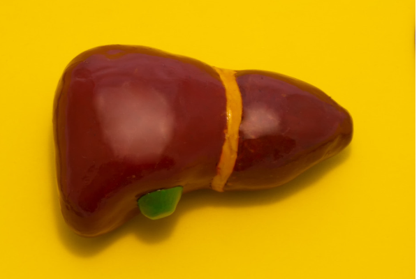 Liver cysts-1